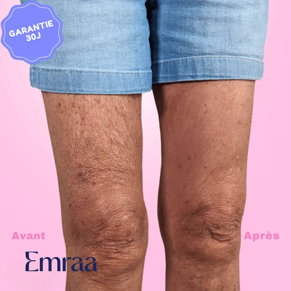 Bande de Maintien EMRAA