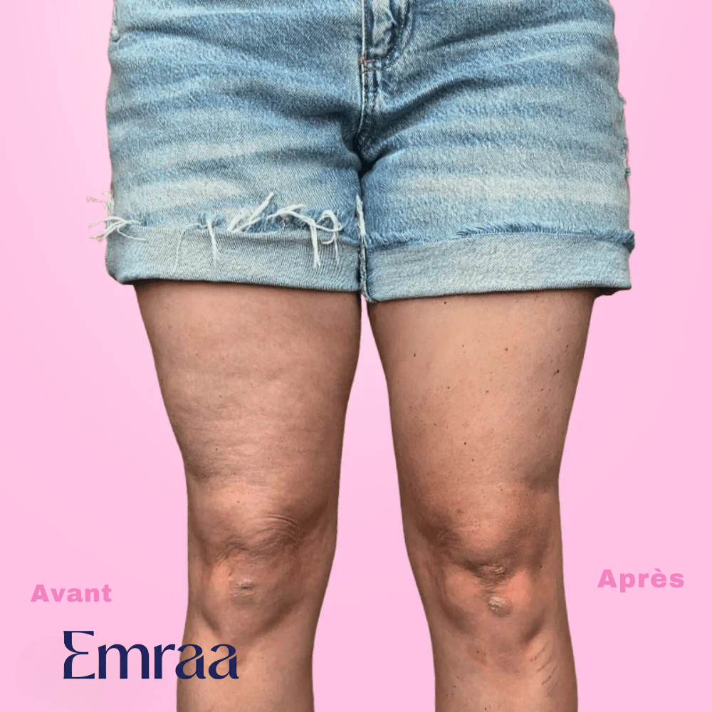 Bande de Maintien EMRAA