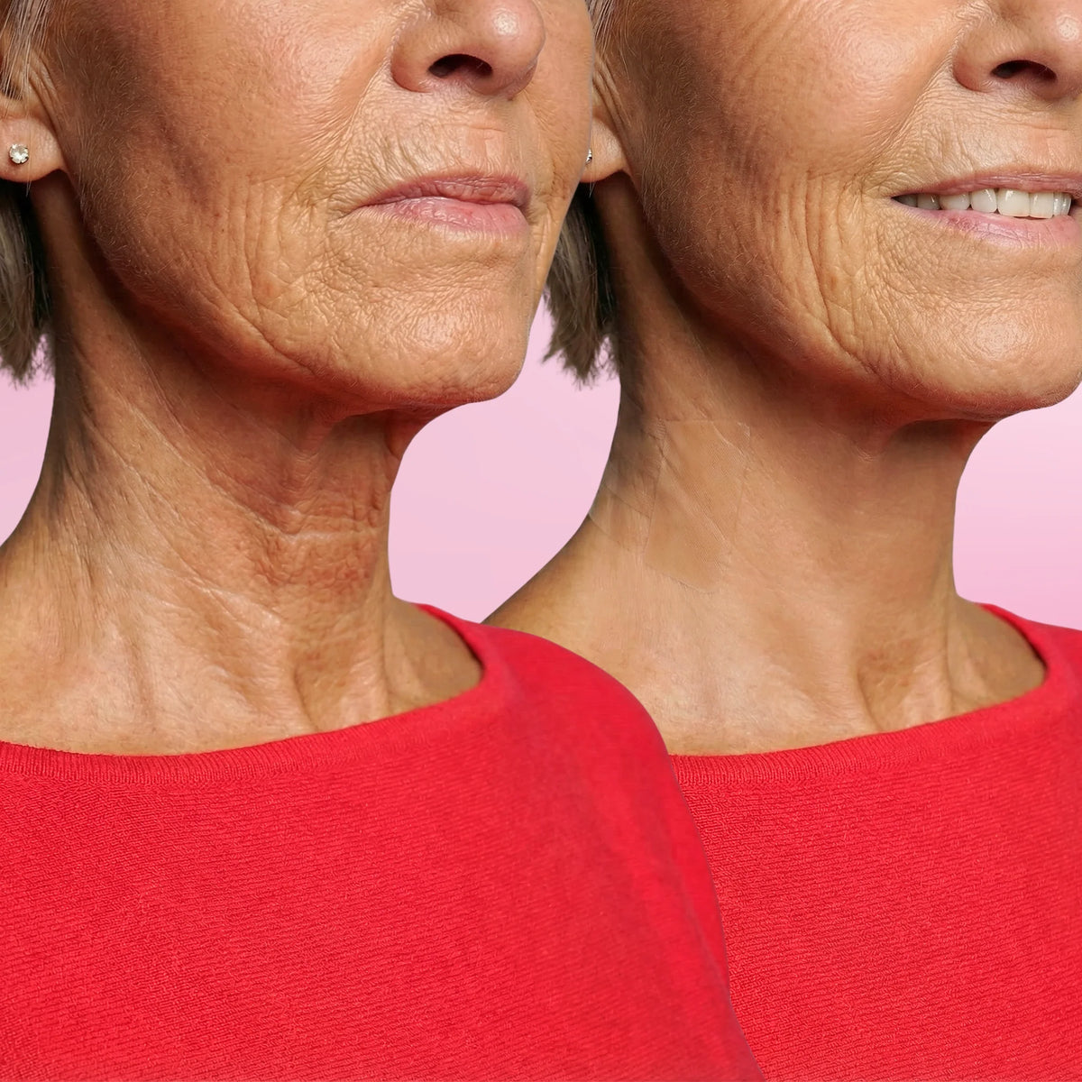 Bande de Maintien Cou EMRAA