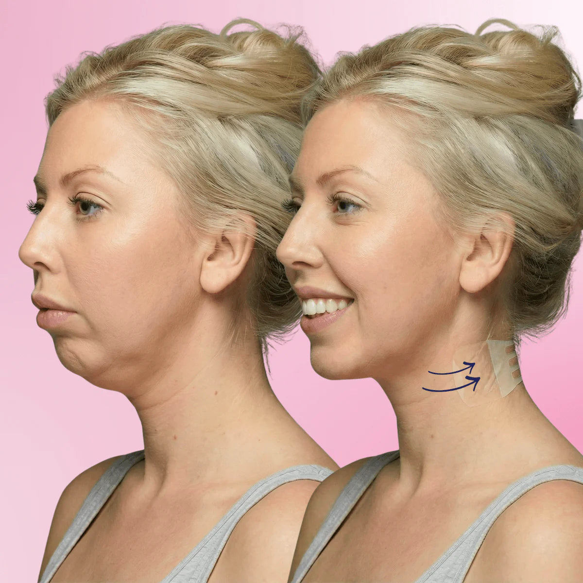 Bande de Maintien Cou EMRAA